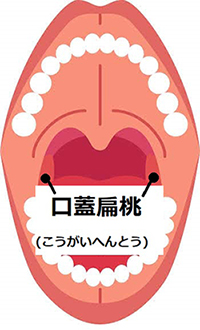 200117_のど痛_02s