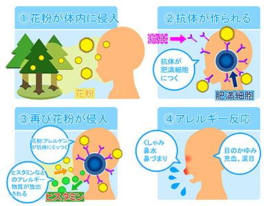 200219_ゾレア_前編[1]