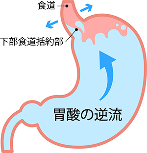 200403_逆食2_三輪医師