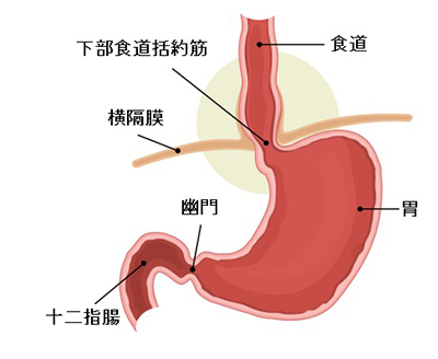 Hiatal,Hernia,And,Normal,Anatomy,Of,The,Stomach