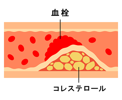 pixta_12381125_S
